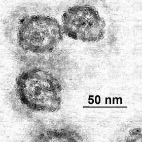 Wirus HCV pod mikroskopem elektronowym. W maju władze amerykańskie dopusciły na rynek dwa leki zwalczające wirusa zapalenia wątroby C. Victrelis firmy Merck uderza w wirusową proteinę zwaną proteazą NS3.  Drugi lek to Incivek firmy Vertex Pharmaceuticals.
