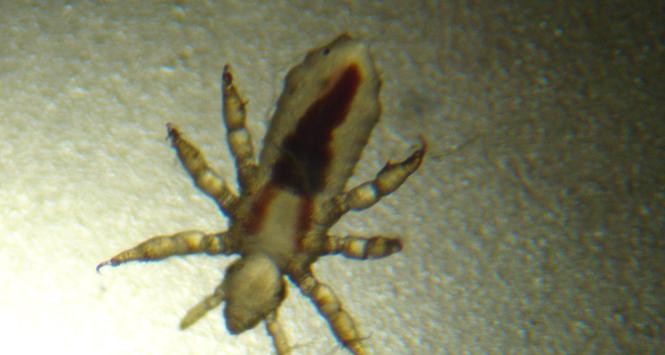 Nie ma się czego wstydzić. Nowoczesna wesz nie bierze sie z biedy, tylko z brudu.